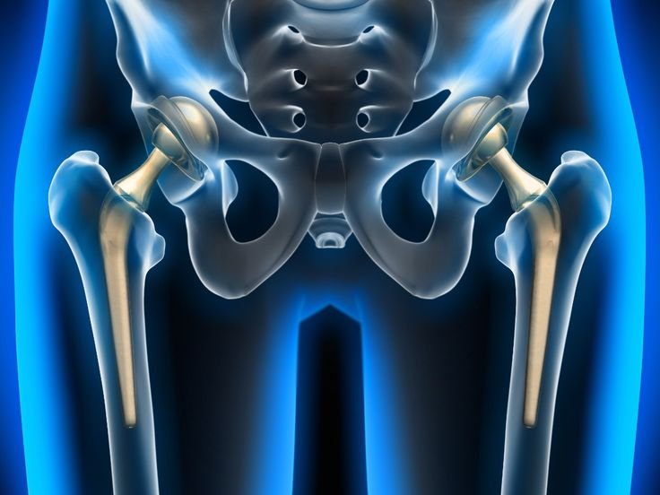 Hip Replacement Surgeon In Chandrapur