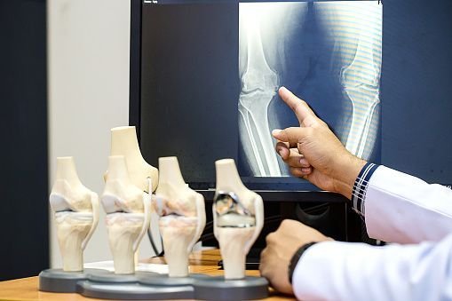 Orthopedic Surgeon In Kagaznagar